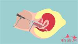 41岁供卵生女儿_高龄女性备孕时需要做哪些身体检查？