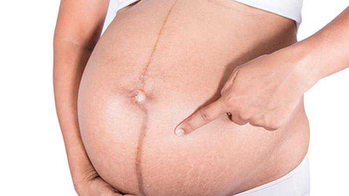 医生说有些孕妇的“肚皮”真有可能被撑破，是真的！